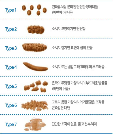 브리스톨 대변 도표