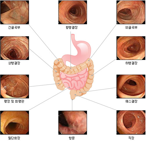 대장내시경 검사 목적